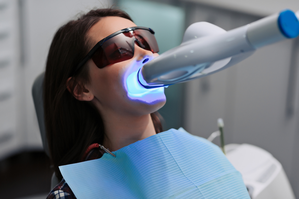 laser whitening treatment