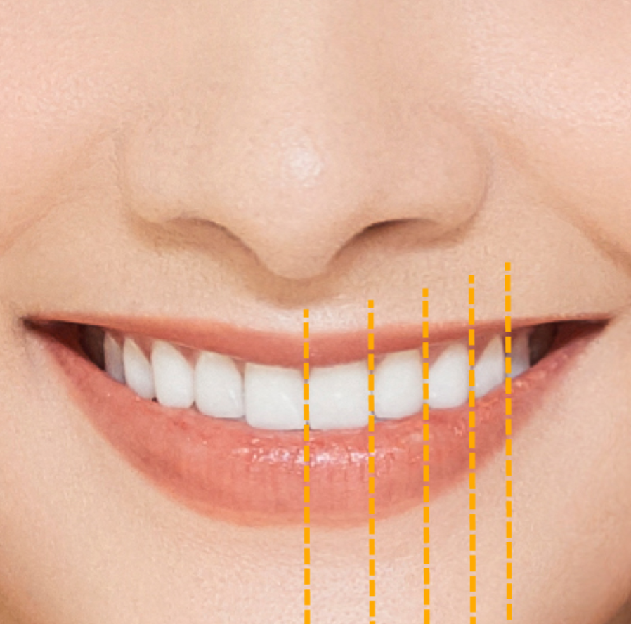 Perfect Hollywood Smile with experts
