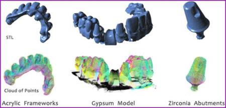 designed crowns and resin bridge