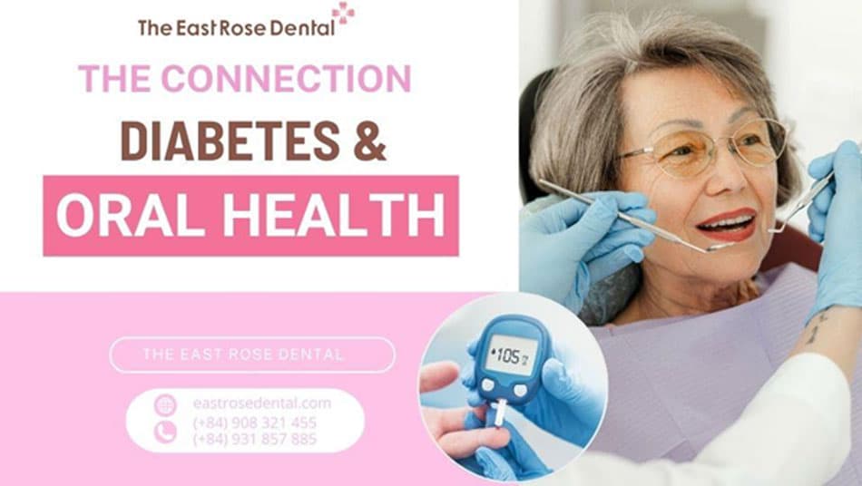 Overview of Diabetes and Its Connection to Oral Health