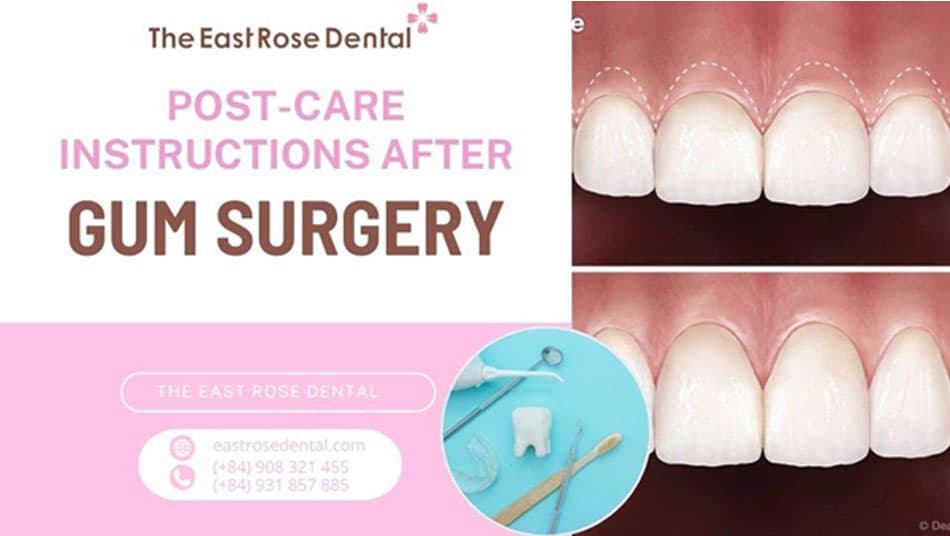 Post-operative care for aesthetic gum surgery