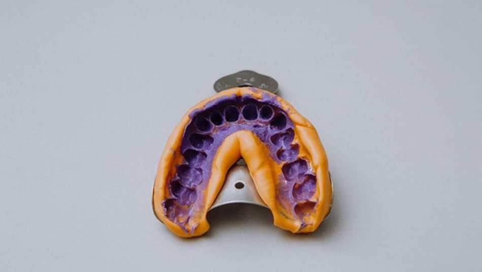 Everyone has unique dental impressions