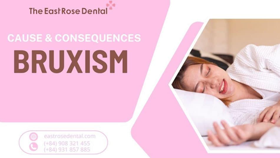 Causes and Serious Consequences of Prolonged Bruxism