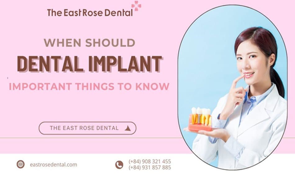 When Do You Need Dental Implants? Essential Conditions to Consider