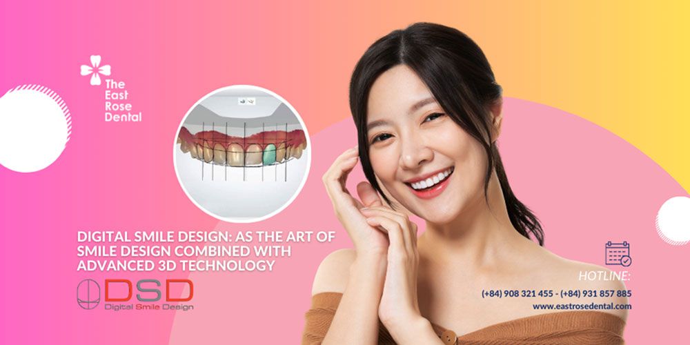 Digital Smile Design: As The Art Of Smile Design Combined With Advanced 3d Technology
