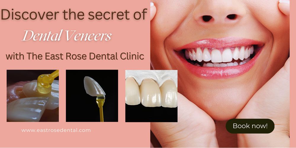 Discover the Secret of Veneer: Pros and Cons