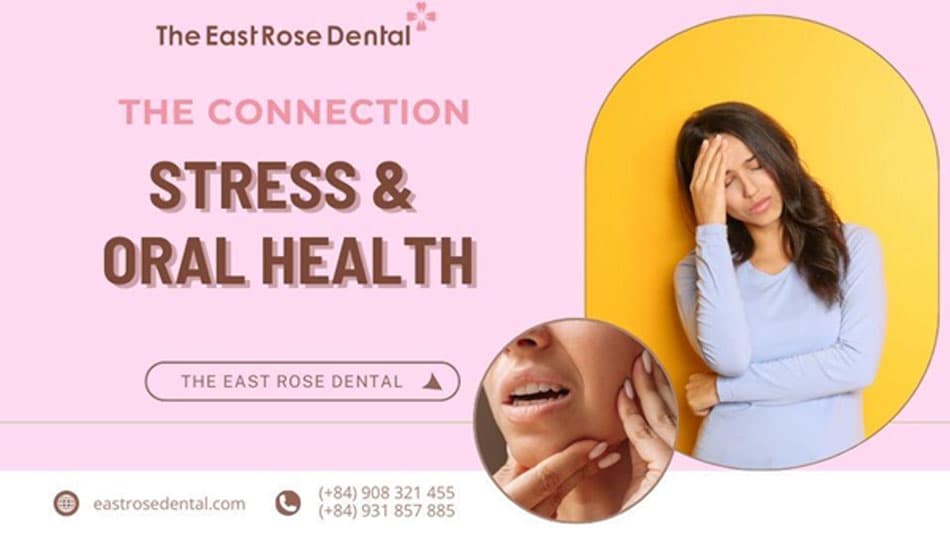 The impact of stress on oral health and effective solutions are discussed.