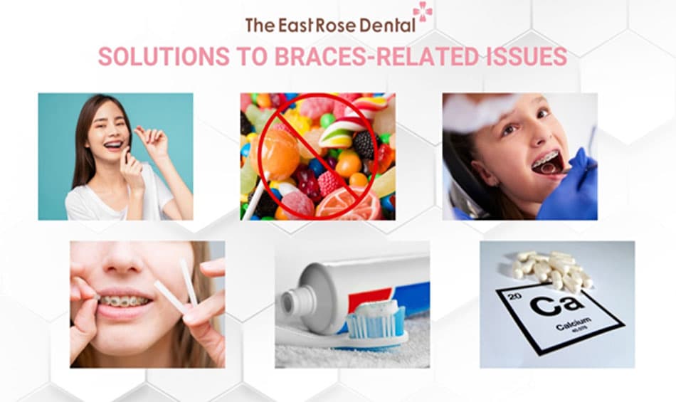 How to address issues during braces treatment