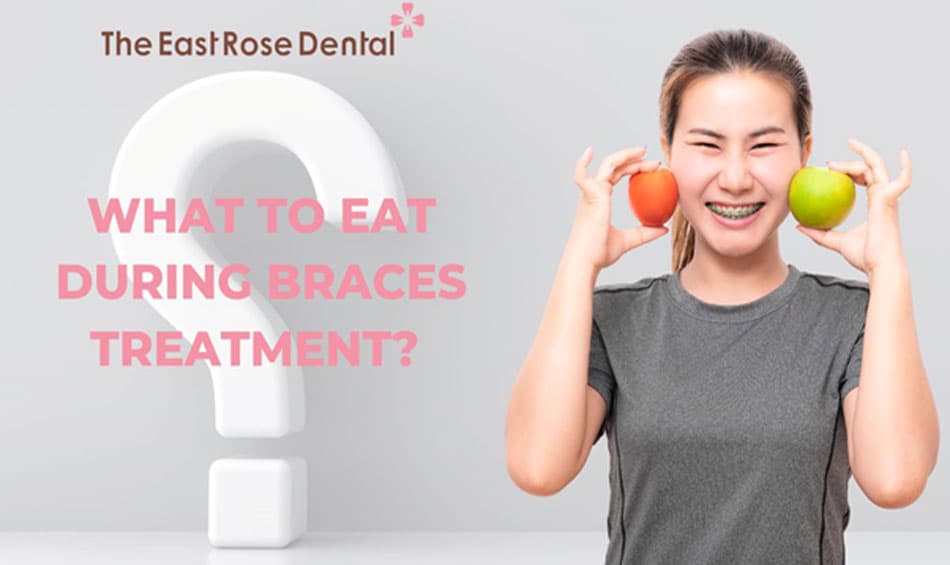 A balanced diet helps achieve optimal results from orthodontic treatment