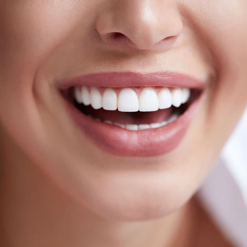 Revealing how to choose the most beautiful and natural color of ceramic teeth for you