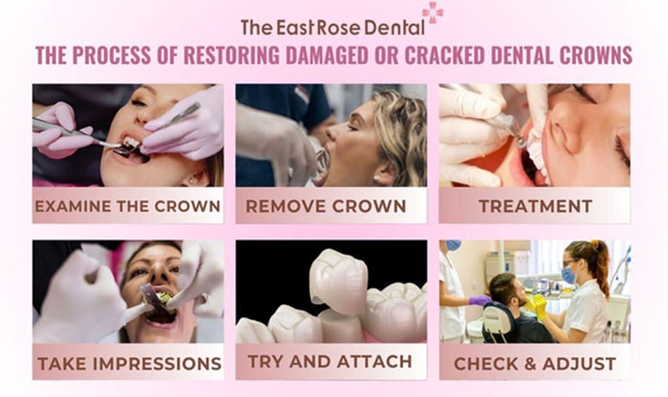 Process for restoring damaged or cracked dental crowns