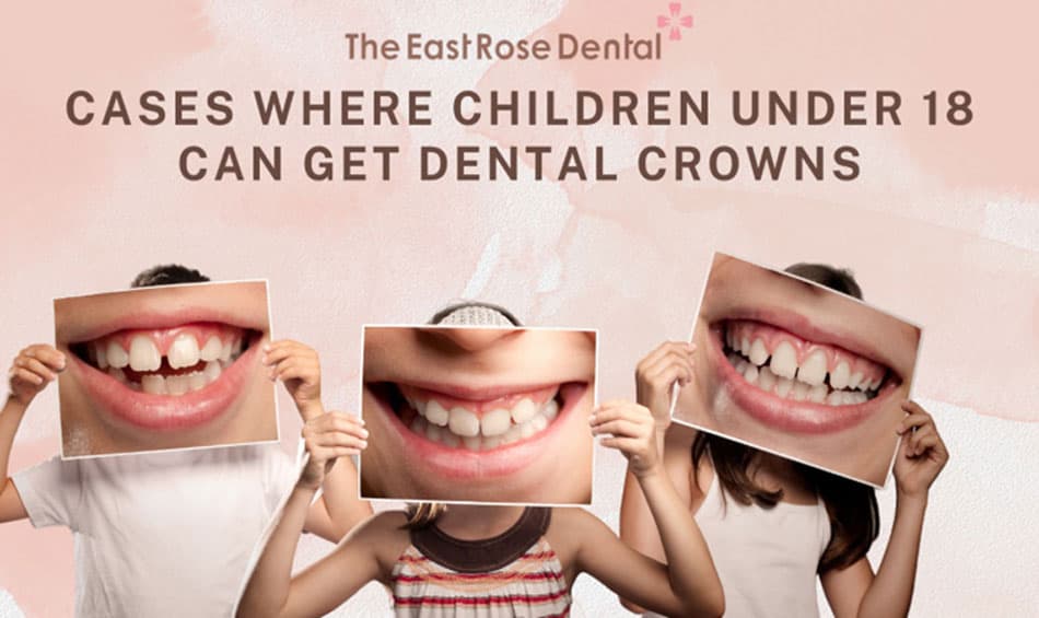 Cases of children under 18 who can use dental crown methods