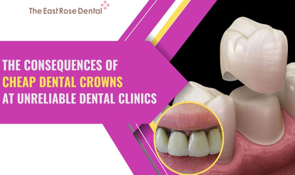 Cheap dental crowns at unreliable dental clinics