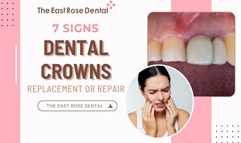 7 Warning Signs That Your Dental Crown Needs Replacement or Repair