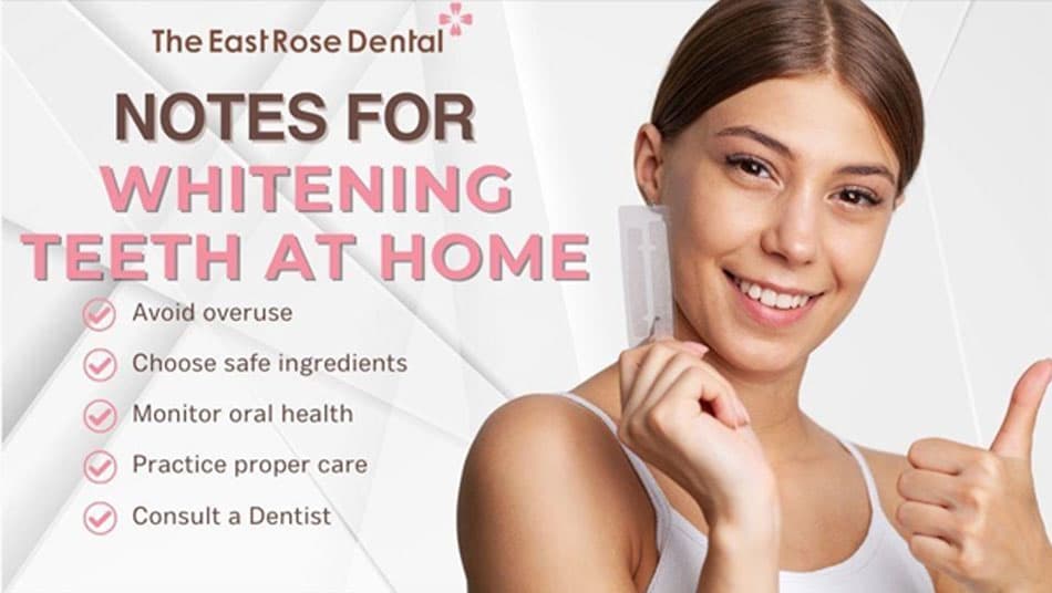 Things to consider before choosing at-home teeth whitening