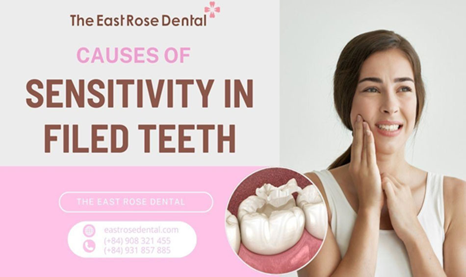 What are the causes of tooth sensitivity after fillings and what are the effective remedies?