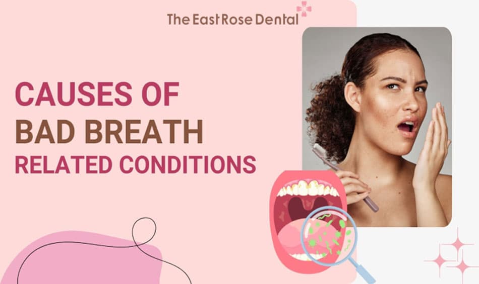 Bad Breath: Main Causes and Related Conditions