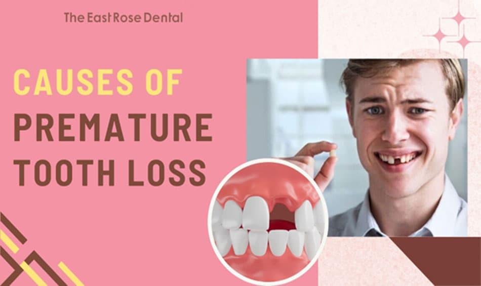 Causes of Premature Tooth Loss and Alarming Consequences