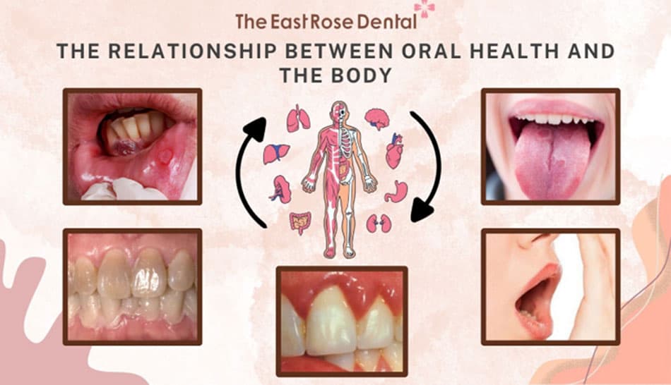 The relationship between oral health and overall body health