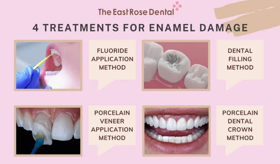 Treatment for Enamel Damage