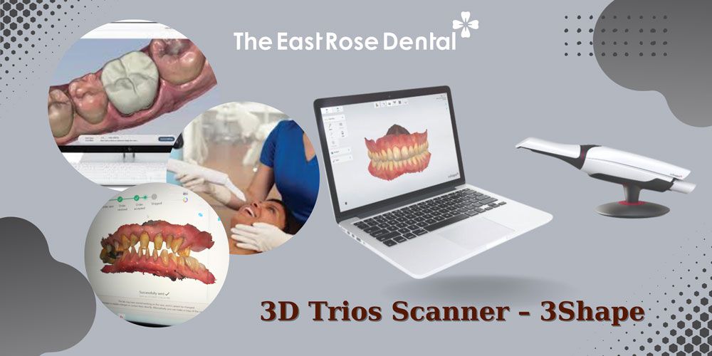 3D Trios Scanner - 3Shape: Innovative technology for superior dental experience