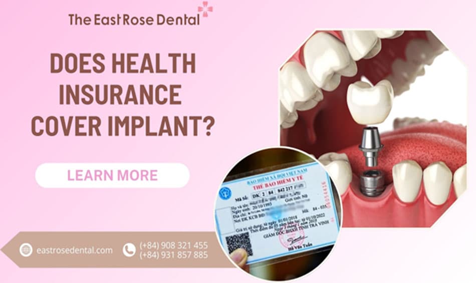 Health insurance does not apply to dental implant services