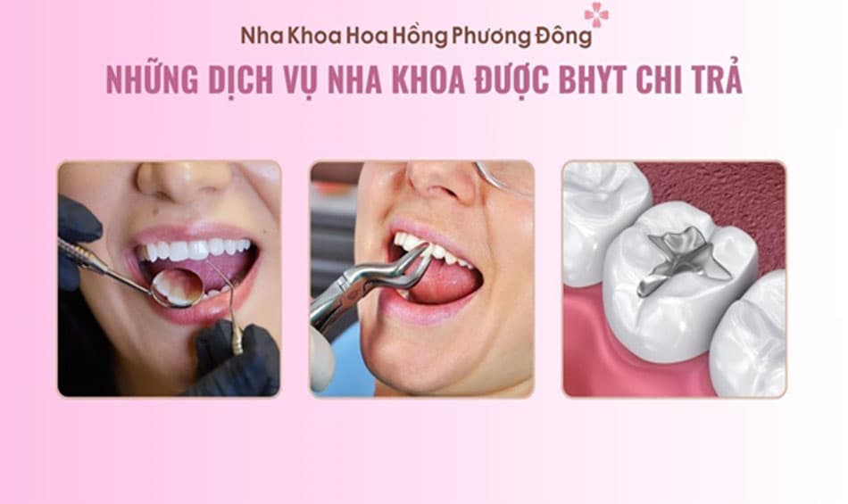 Bảo hiểm y tế chi trả những dịch vụ nha khoa liên quan đến bệnh lý và chức năng