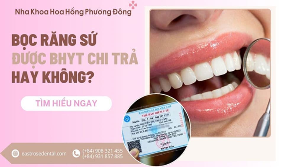 Bọc răng sứ có được bảo hiểm y tế chi trả không