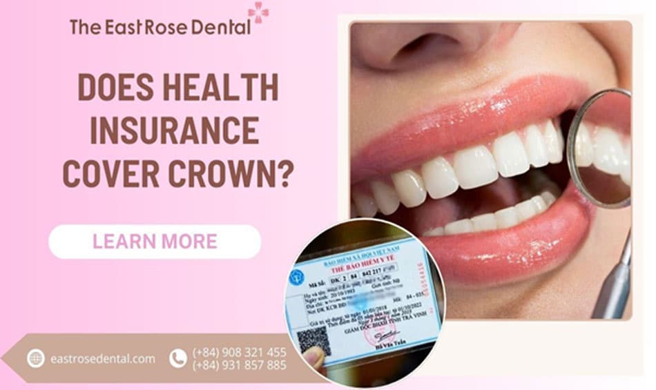 Cosmetic dental crowns are not covered by health insurance