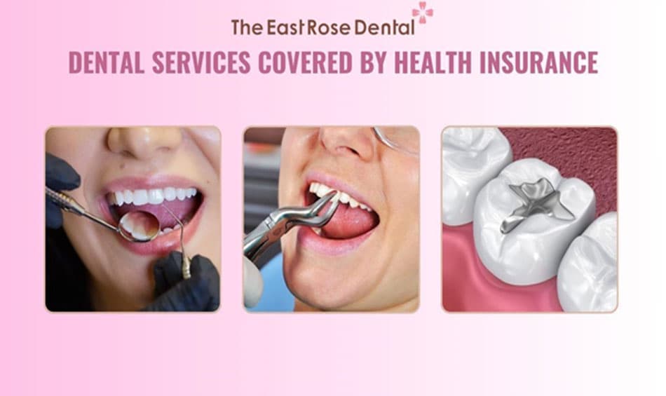 Health insurance covers dental services related to medical conditions and function