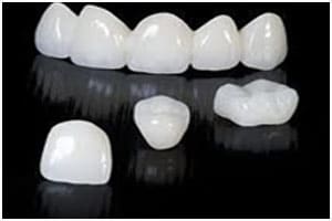  Pure Zirconia crowns