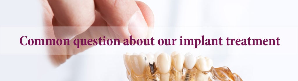 Answering common questions about dental implant - Part 1