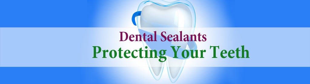 Dental Sealants – Protecting Your Teeth