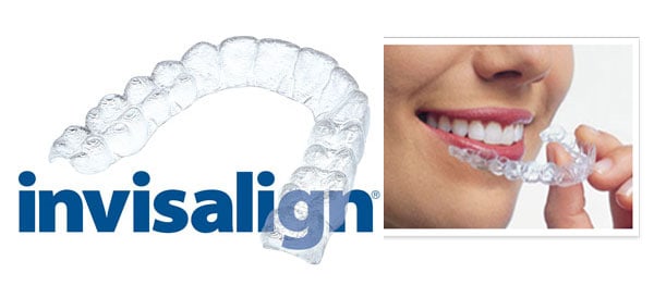 invisalign