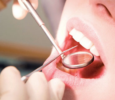 Teeth care