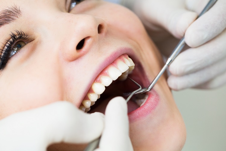 What are dental inlays and onlays? 