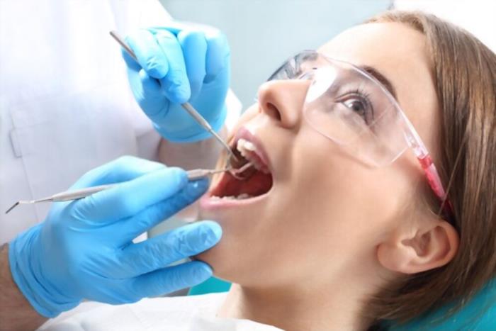 Can a cavity come back after fillings?