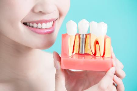 How painful are dental implants?