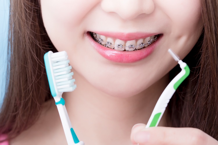 interdental brushes for braces