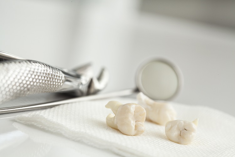 Is wisdom tooth extraction dangerous?
