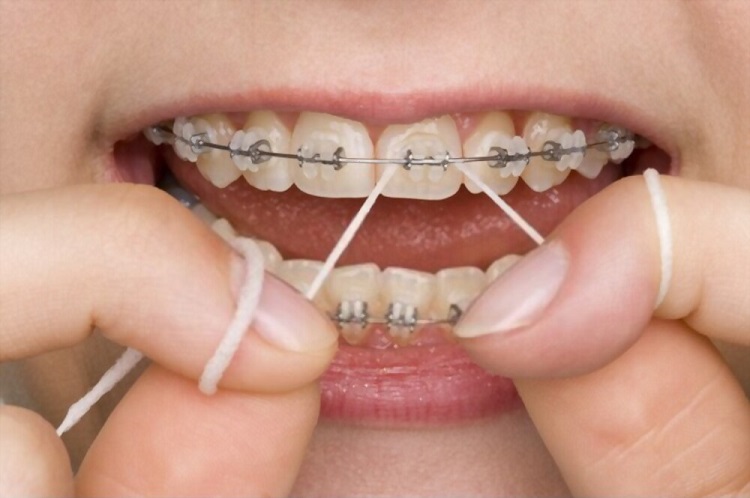 Floss properly