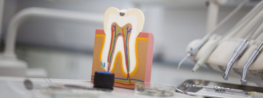 What is root canal treatment? Problem, Process and Recovery
